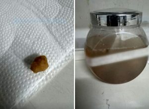 padrao-foto-g1-goias-7-